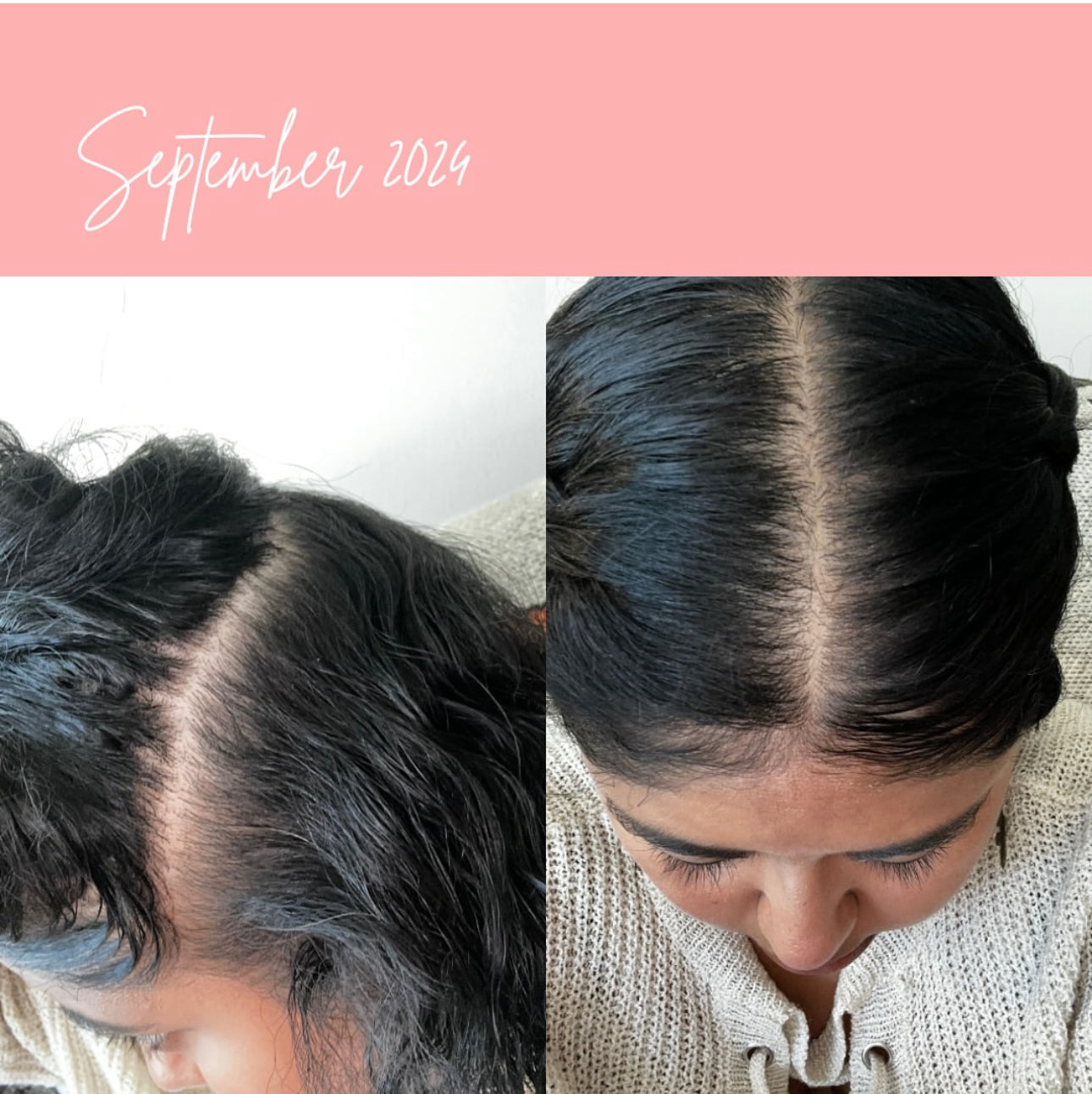 Cabello Abundante- Hair Growth Oil