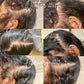 Cabello Abundante- Hair Growth Oil